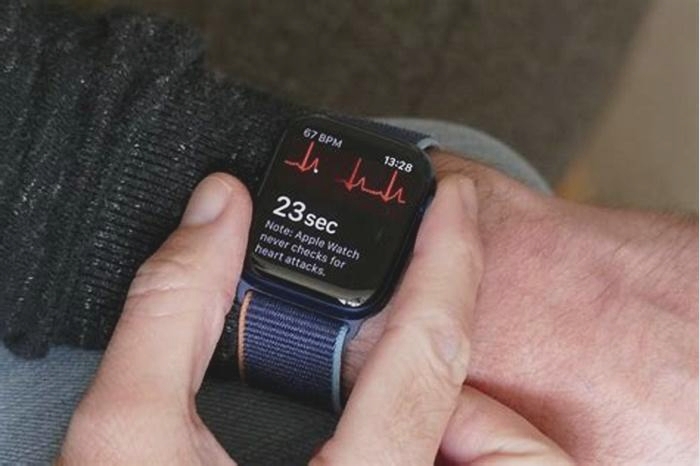 The Easy Way to Use Your Smartwatch to Take an ECG